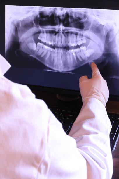 Best Broken Tooth Emergency  in Leadwood, MO