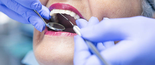 Best Affordable Emergency Dental Care  in Leadwood, MO