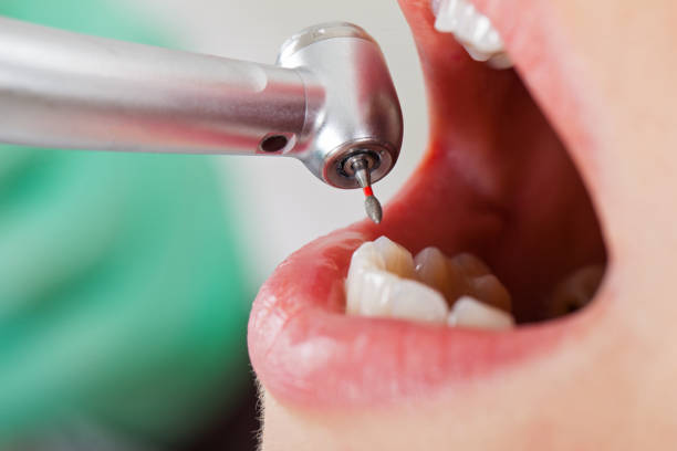 Best Cracked Tooth Emergency Dentist  in Leadwood, MO
